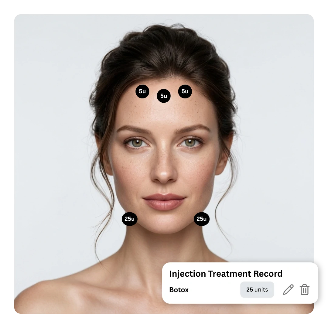 DaySpark injection treatment record with face map, lot tracking, and treatment summary